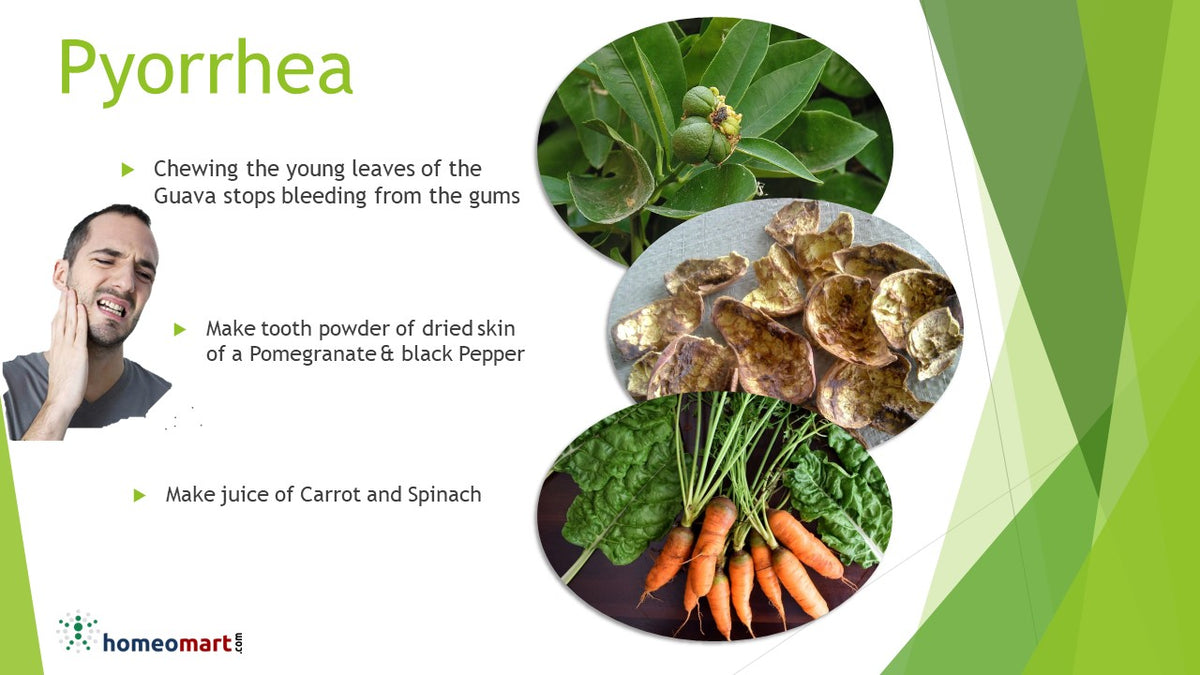 Naturopathy treatment for Pyorrhea or Gum infection, Disease – Homeomart