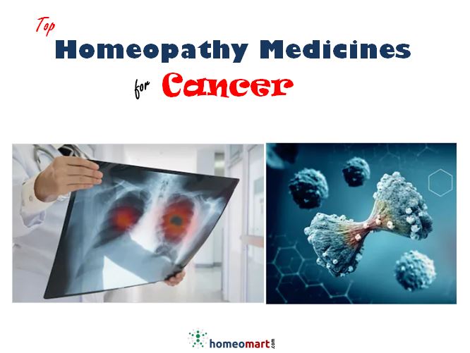 Dr. Khaneja's Homeopathic Remedies for Cancer Treatment