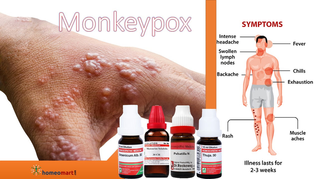 monkepox treatment homeopathy medicines