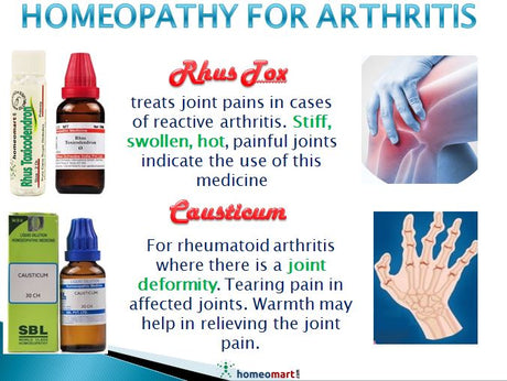 homeopathy arthritis relief medicines