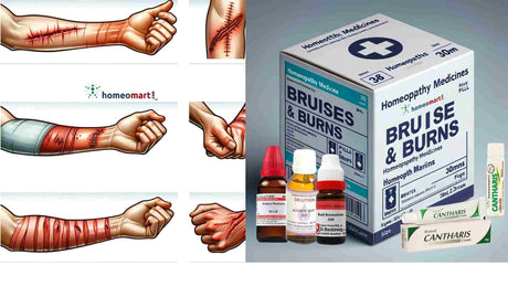 Homeopathy Pain Relief Medicines for Injury, Bruises, Body Pain, Strain