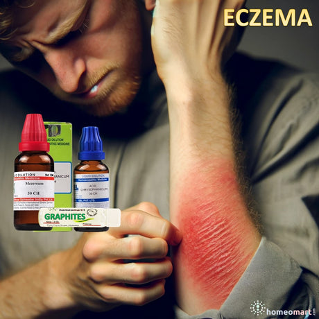 Eczema treatment in homeopathy medicines list