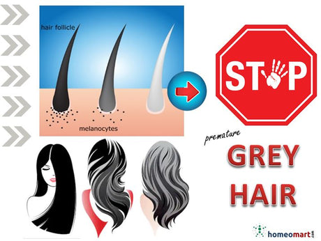 grey hair treatment homeopathy medicines