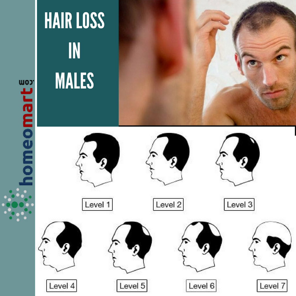 Homeopathy Medicines Collection: Hair Fall Control and Regrowth for Males and Females