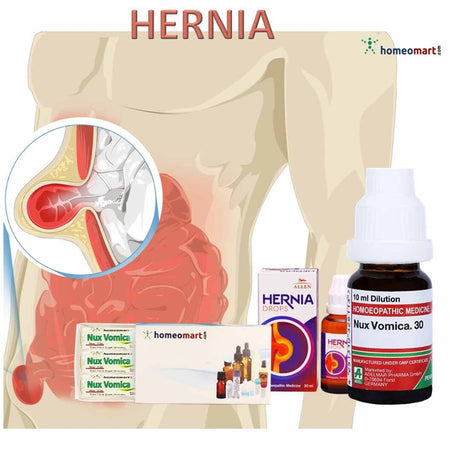 Hernia treatment homeopathy medicines