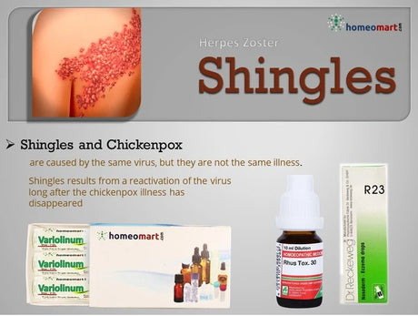 Homeopathic Herpes Zoster Treatment - Best Shingles Relief Medicines