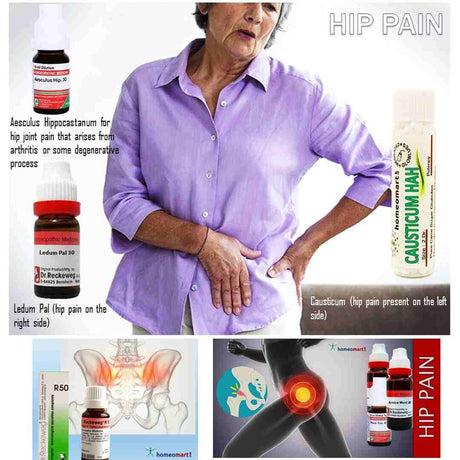 Best Homeopathic Medicines for Hip Pain Relief