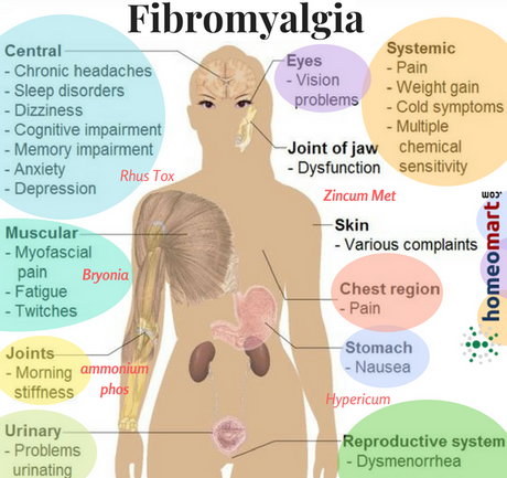 Fibromyalgia Homeopathy Medicines