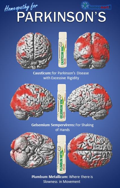 commonly used homeopathic medicines for Parkinson’s disease