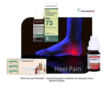 Comprehensive Homeopathic Treatment Options for Heel Discomfort from heel spurs