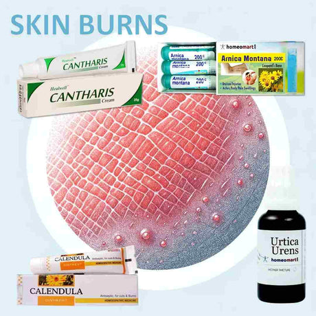 Homeopathic Burn Care Collection - Natural Remedies for Burns & Blisters