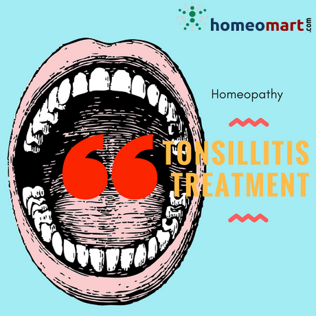 Homeopathy Tonsillitis Medicines List