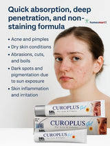 Achieve clear, radiant skin with SBL Curoplus Gel! This homeopathic formula deeply penetrates to heal acne, reduce dark spots, and soothe skin irritation. Quick absorption, non-greasy, and powered by nature’s best remedies for flawless skin.