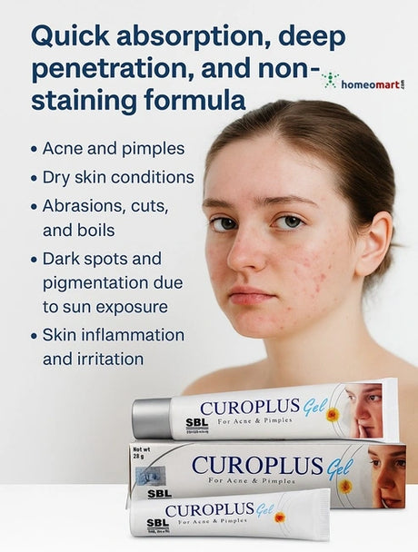 Achieve clear, radiant skin with SBL Curoplus Gel! This homeopathic formula deeply penetrates to heal acne, reduce dark spots, and soothe skin irritation. Quick absorption, non-greasy, and powered by nature’s best remedies for flawless skin.