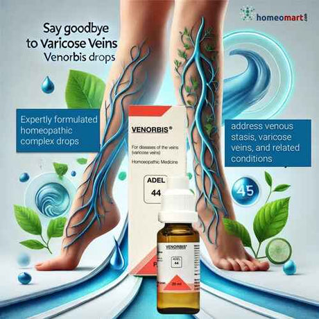 varicose veins treatment medicine homeopathic