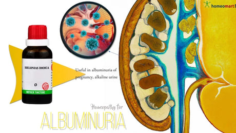Homeopathic remedy bottle labeled 'Albuminuria' with anatomical illustration showing high content of urine protein