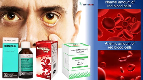 Anemia symptoms and natural remedies in homeopathy