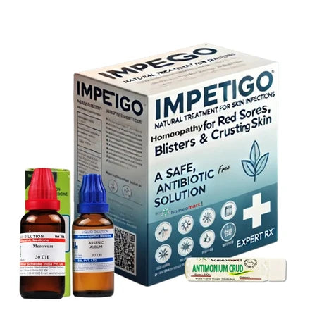 homeopathic medicines for impetigo, treating red sores, blisters & crusty skin. Safe, natural, and effective antibiotic-free relief.