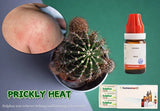 Homeopathic Remedies for Heat Rash – Natural Prickly Heat Treatment ...