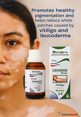 Bhargava Lecodin Drops bottle and box with a woman's face showing white patches.