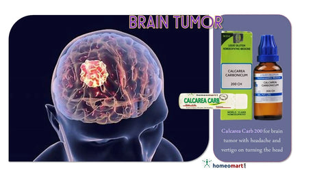 Homeopathic cure for brain tumor symptoms