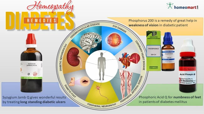 Homeopathy remedies for diabetes with product images and descriptions.