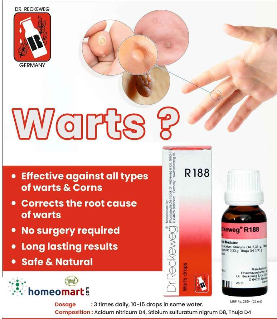 warts treatment in homeopathy R188 German drops