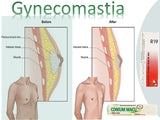  Gynecomastia Treatment with natural safe remedies for 100% results
