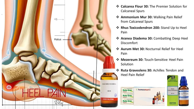 Illustration of heel pain with product solutions on a white background