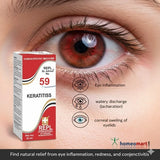 Eye with redness and a homeopathic medicine box labeled 'Keratittiss' on a close-up of an eye.