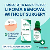 Wheezel Liporex lipoma removal product with packaging and dropper bottle on a light blue background.