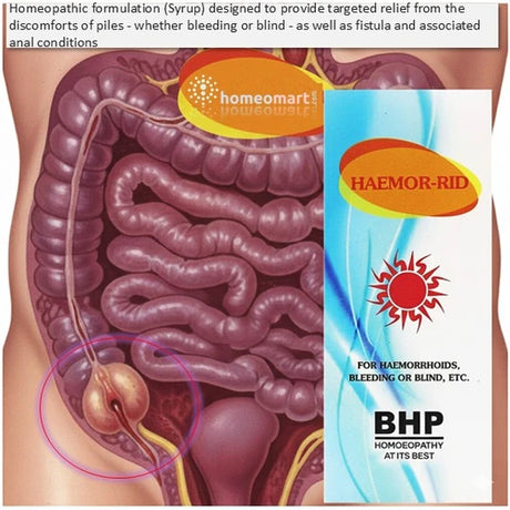 Illustration of a medical diagram with 'HAEMOR-RID' packaging on a white background