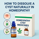 Homeopathy cyst medicines with a bottle and box on a light blue background illustrating How to dissolve a cyst naturally 