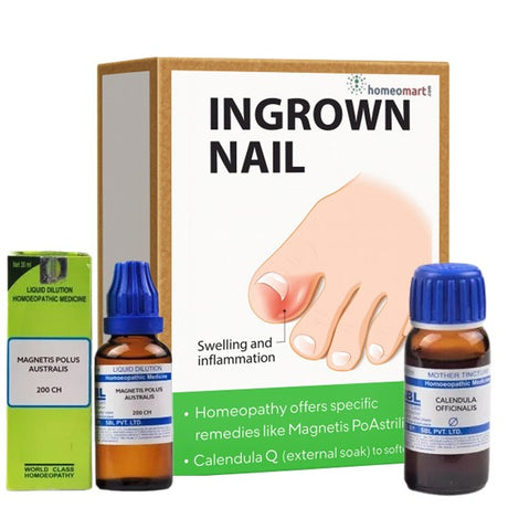 Homeopathy treatment for ingrown nails with bottles and packaging on a white background