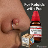 Myristica Seb 200 hastens pus discharge and healing in keloids from piercing scars, tattoo scars, vaccination scars, medicine for itchy keloid scars, homeopathic treatment for acne keloids, remedy for piercing keloids naturally, medicine for painful keloid scars