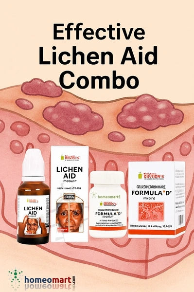 Bakson Lichen Aid Drops - Relief for Lichen Planus Symptoms