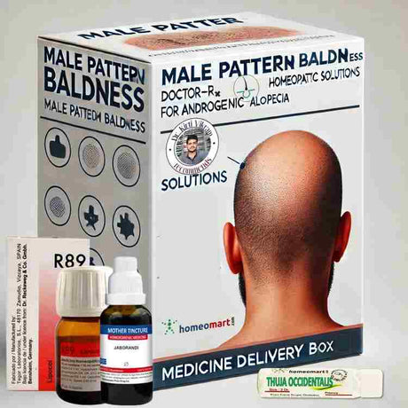 male pattern baldness treatment homeopathy medicines