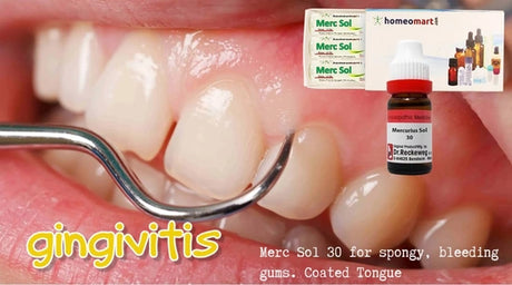 Homeopathic Mercurius Solubilis 30 – For spongy, bleeding gums with sore pain in Gingivitis
