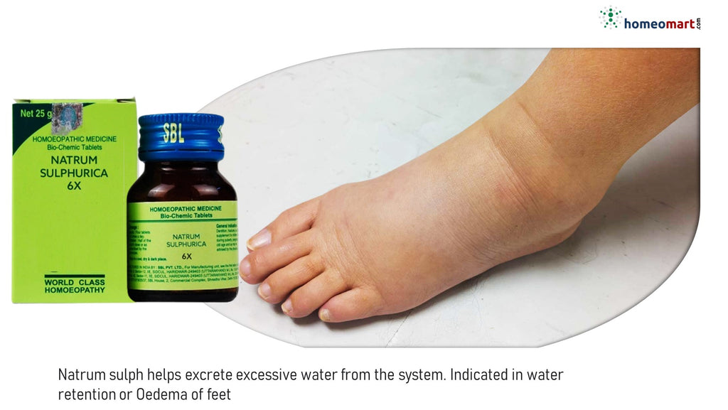 Treatment for swelling in legs and feet
