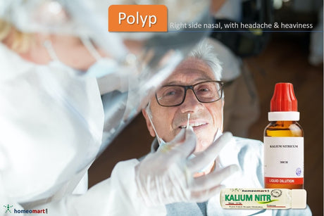 polyps in nose homeopathic medicine kali nitricum