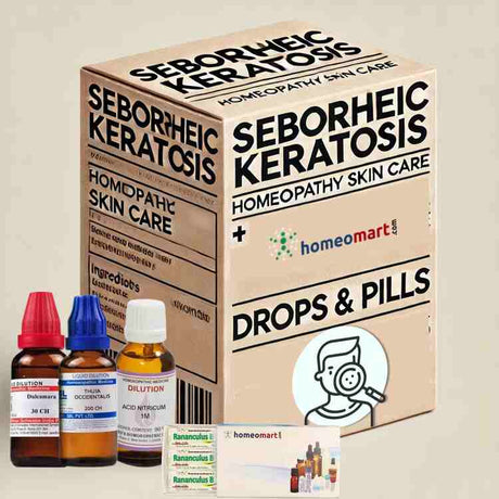 Seborrheic Keratosis Treatment Homeopathy Medicines