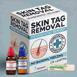 skin tag removal homeopathy medicines