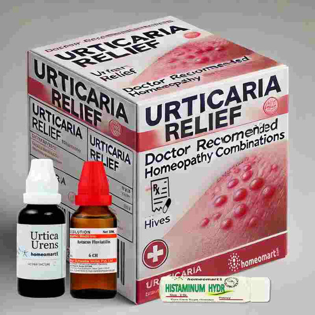 Urticaria (Hives) treatment homeopathy Medicine Kit