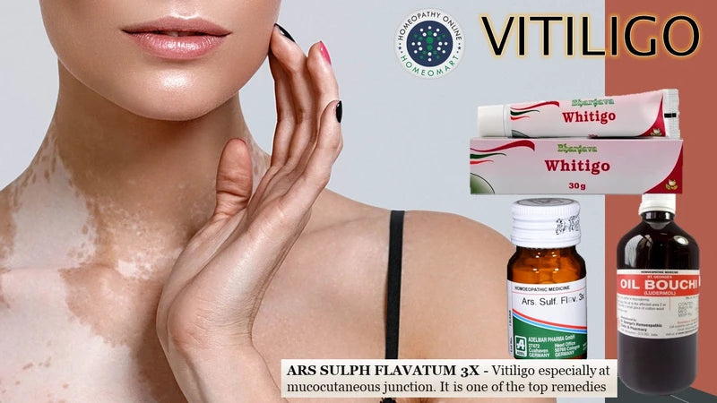 Advertisement for vitiligo treatment with images of a person's neck, bottles, and packaging.