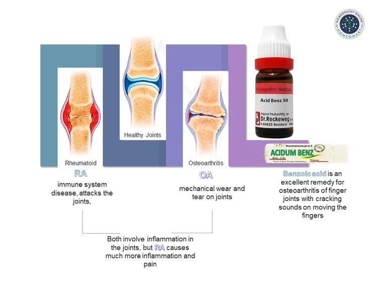 Illustration of joint conditions with a bottle labeled 'Acidum Benz' and text explaining joint health.