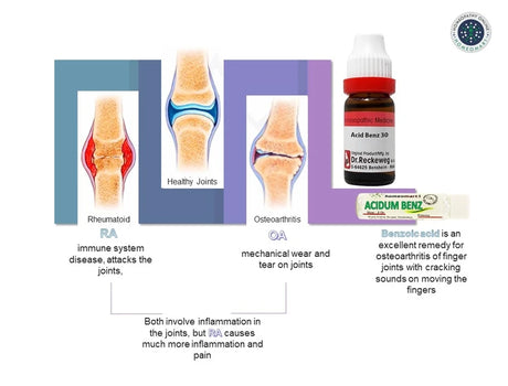 Illustration of joint conditions with a bottle labeled 'Acidum Benz' and text explaining joint health.