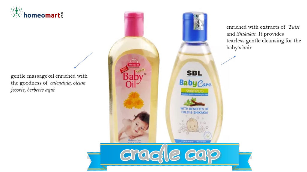 cradle cap gentle external baby oil and shampoo