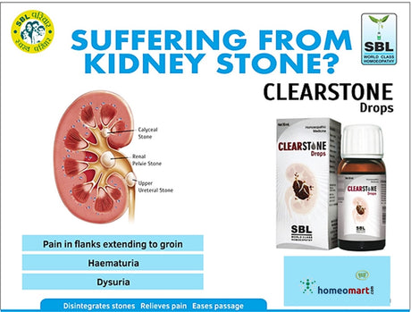 SBL Clearstone Drops for Kidney & Bladder Stones