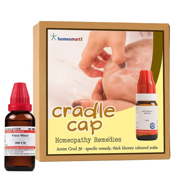 Homeopathy remedies for cradle cap with a Homeomart! branded box in the background.