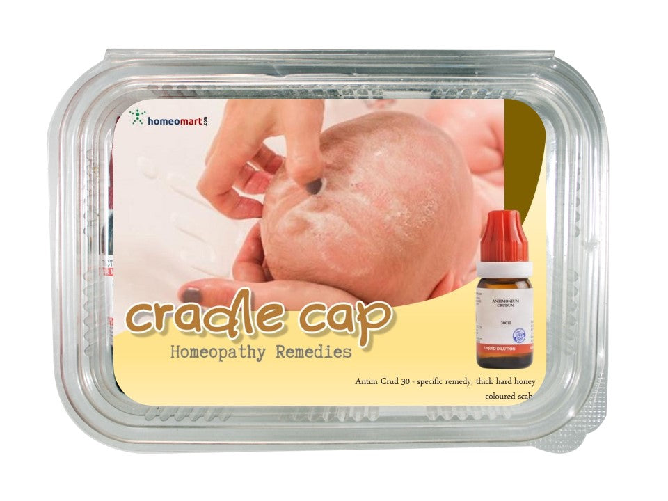 Cradle cap treatment homeopathy medicines